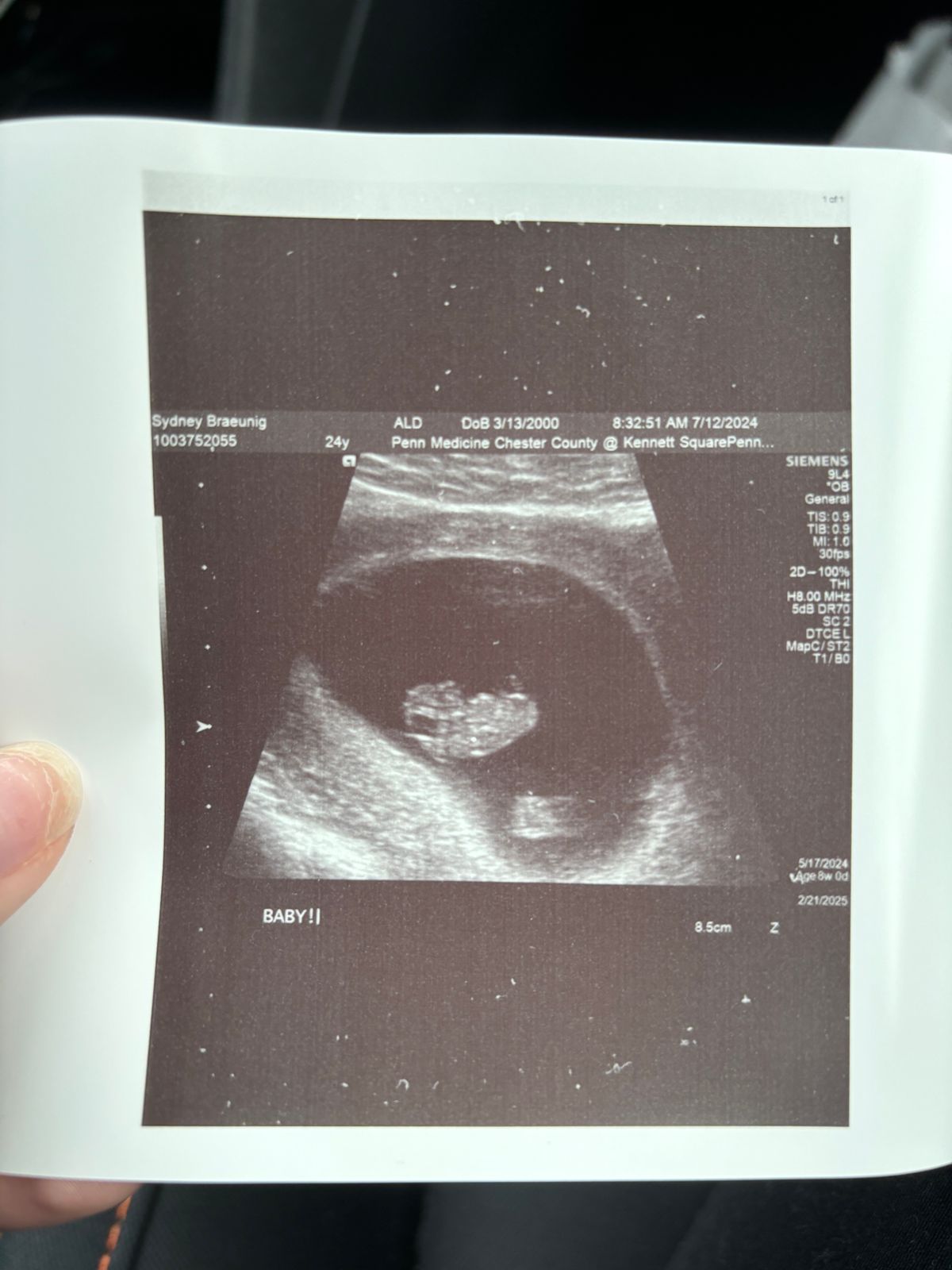 Ultrasound baby pic